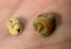 Picture of   Ancient Egypt. NEW KINGDOM. 1400 - 1200 B.C .  LOT OF TWO STONE SCARABS